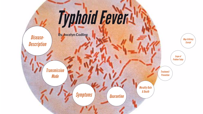 Comment savoir si on a la typhoïde ?