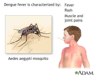 Quels sont les effets de la typhoïde ?